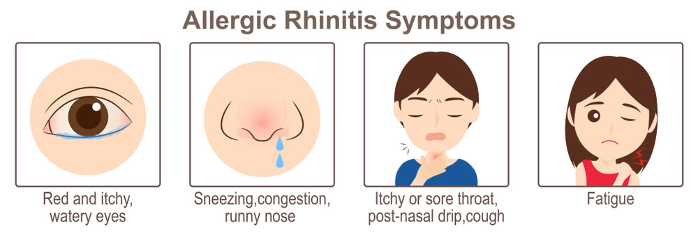 common-clinical-information-regarding-montelukast-practice-updates